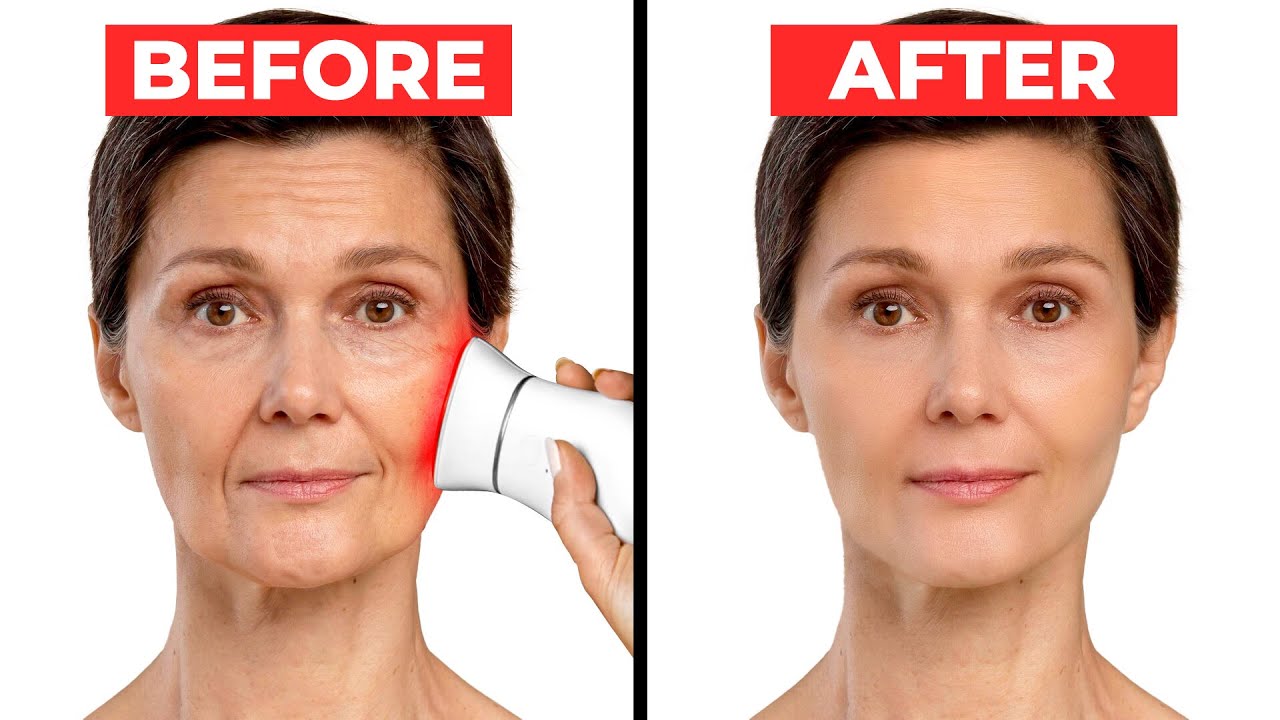 red light therapy before and after